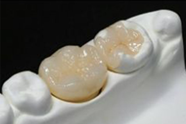 高強度ハイブリッド型硬質レジン